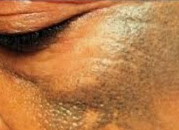 Mamies
